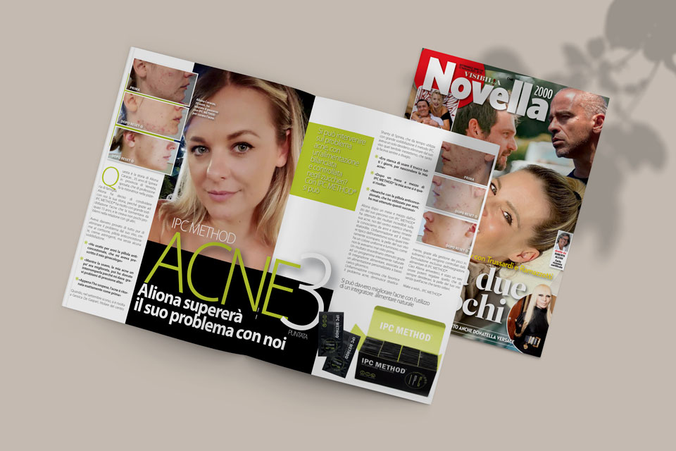 Cura l’acne con IPC Method: Aliona racconta il suo percorso su Novella 2000
