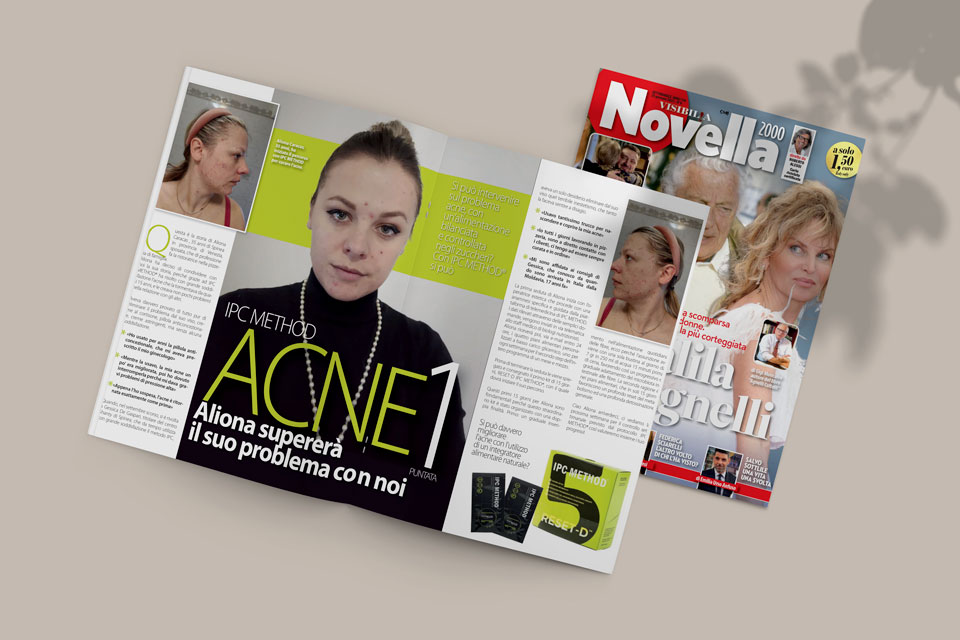 Aliona supera l’acne con IPC Method: consigli su Novella 2000