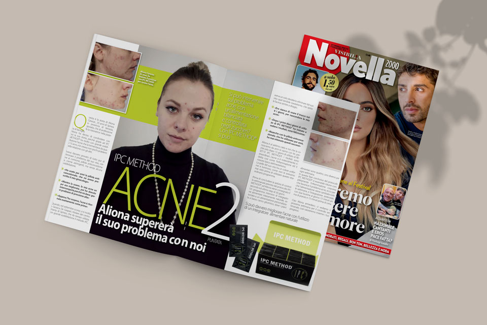 Cura per l’acne con IPC Method: Aliona racconta il suo percorso su Novella 2000